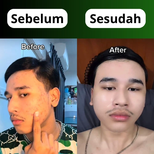 2 (2)